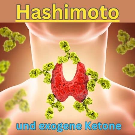 Darf man bei Hashimoto exogene Ketone nutzen?